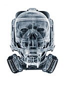Skull and wearing a gasmask, X-ray