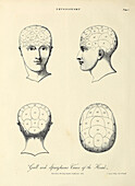 Four views of the head, 19th century illustration