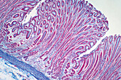 Colon biopsy, light micrograph