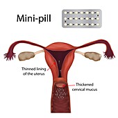 Mini-pill, illustration