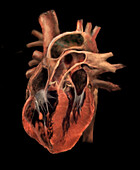 Heart Revealing Chambers and Valves