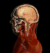 Brain and Nasal Cavity, Male Head