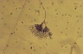 Penicillium, light micrograph