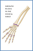 Hand Growth Plates, Illustration