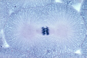 Dividing cell in anaphase stage of mitosis, light micrograph