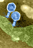 T2 bacteriophages, TEM
