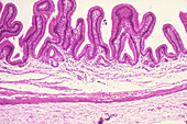 Gall Bladder, LM