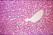 Hepatocytes and Sinusoidal Channels, LM