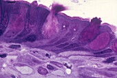 Goblet Cells Releasing Mucus, LM