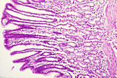 Pyloric Stomach Cells, LM