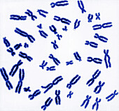 Human Chromosomes