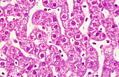 Liver, Hepatocytes, LM