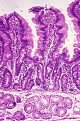 Duodenum, LM