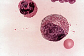 Myelocyte, LM