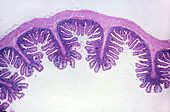 Ileum, LM