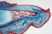 Terminal Phalanx of Human Finger, LM