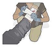 Bandaging leg with burst varicose vein, illustration