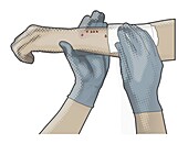 Cleaning injured arm, illustration