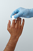 First aid treatment of finger injury