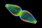 Pleurotaenium ovatum desmid, light micrograph