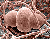 Rhizopus on bread, SEM