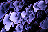 Histidine crystals, light micrograph