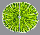 Micrasterias thomasiana, light micrograph