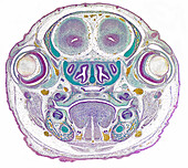 Mouse, fetal head section through eyes, light micrograph