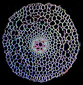 Buttercup root, light micrograph