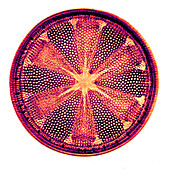 Heliopelta metil diatom, early photomicrograph