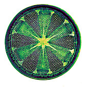 Heliopelta metil diatom, early photomicrograph