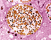 Chlamydia inside epithelial cells of the oviduct, TEM