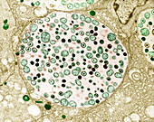 Chlamydia inside epithelial cells of the oviduct, TEM
