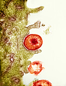 Chlamydia on surface of oviduct, TEM