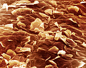 Surface of human skin, SEM