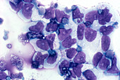 HIV infected macrophages, light micrograph
