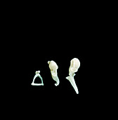 Auditory ossicles