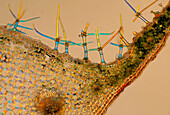 Verbascum sp. leaf, light micrograph