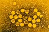 Rotavirus particles, TEM