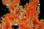 Haematococcus pluvialis algae, light micrograph