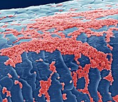 Skin bacteria on hair, SEM
