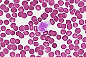 Blood smear, light micrograph