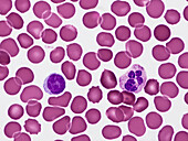 Blood smear, light micrograph