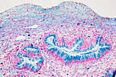 Cervix, light micrograph