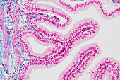 Gallbladder, light micrograph