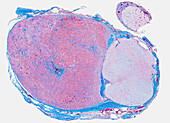 Pituitary gland, light micrograph