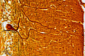 Cerebellum tissue, light micrograph