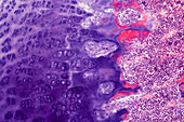 Foetal finger bone, light micrograph