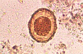 Ascaris lumbricoides egg, light micrograph