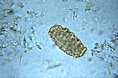 Unfertilised Ascaris lumbricoides egg, light micrograph